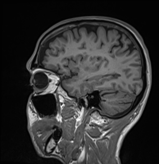 135.jpg