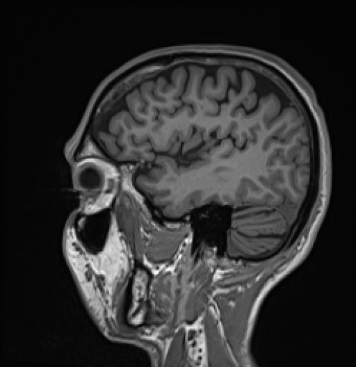 145.jpg