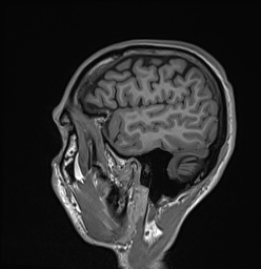 154.jpg