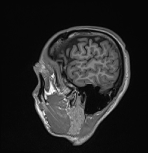 161.jpg