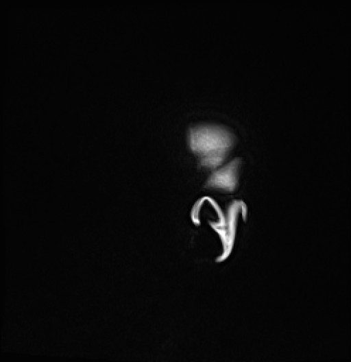 187.jpg