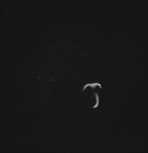 Click on the Serie image to view the images of RANDOM ANYONE