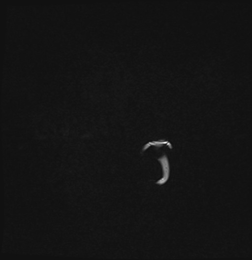 194.jpg