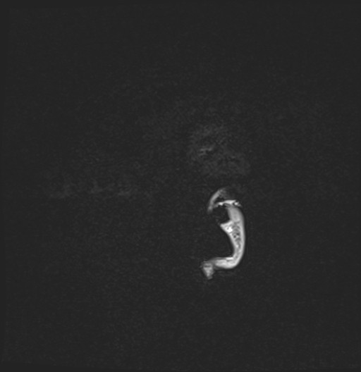 197.jpg
