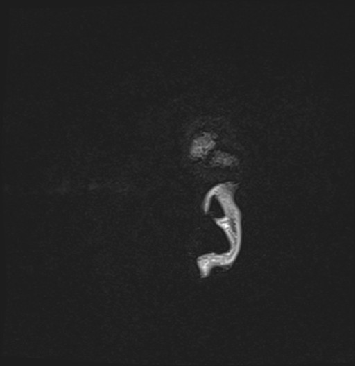 198.jpg