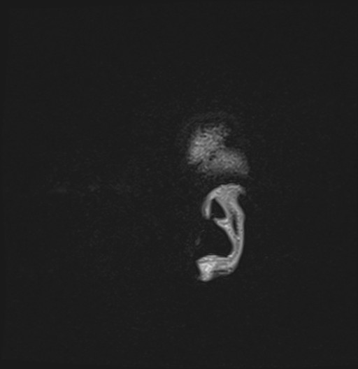199.jpg