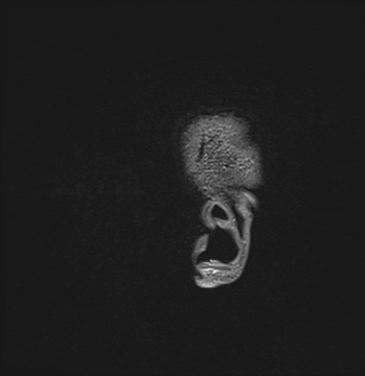 201.jpg