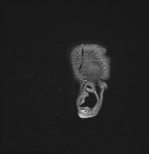 203.jpg