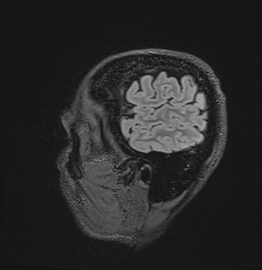 356.jpg