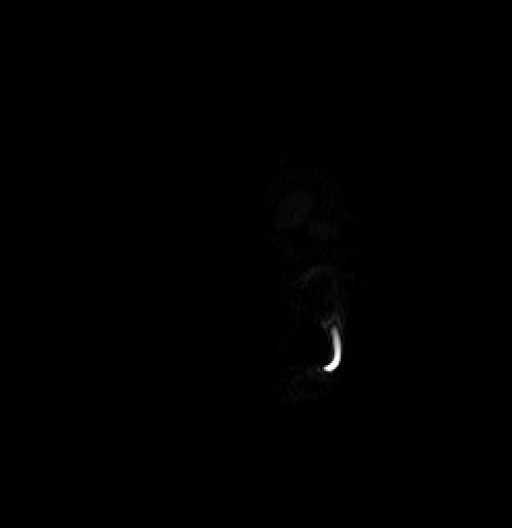 Click on the Serie image to view the images of RANDOM ANYONE