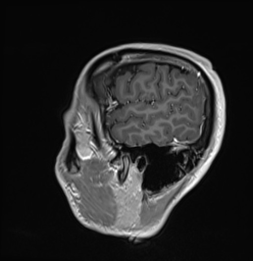 587.jpg