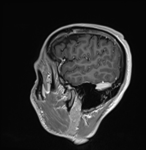 590.jpg