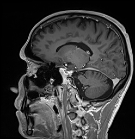 635.jpg
