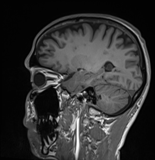 67.jpg