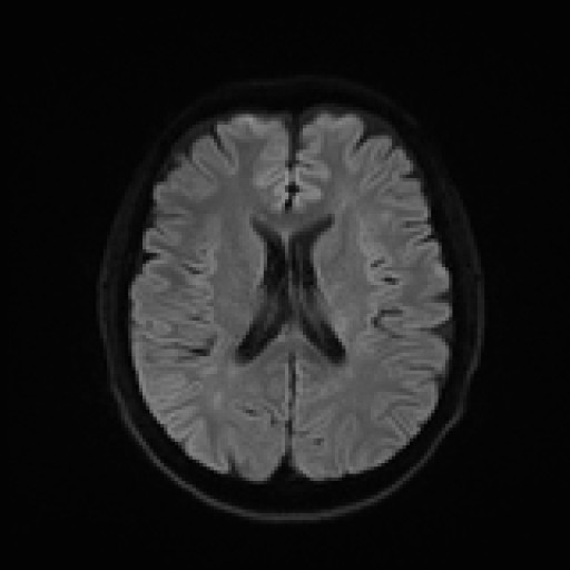 975.jpg