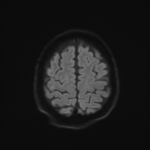 981.jpg