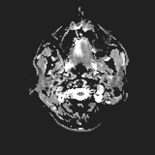 Click on the Serie image to view the images of RANDOM ANYONE